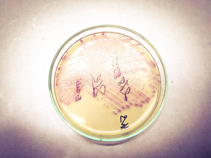 9 3 Media Used For Bacterial Growth Microbiology Canadian Edition 9 3 Media Used For Bacterial Growth Microbiology Canadian Edition