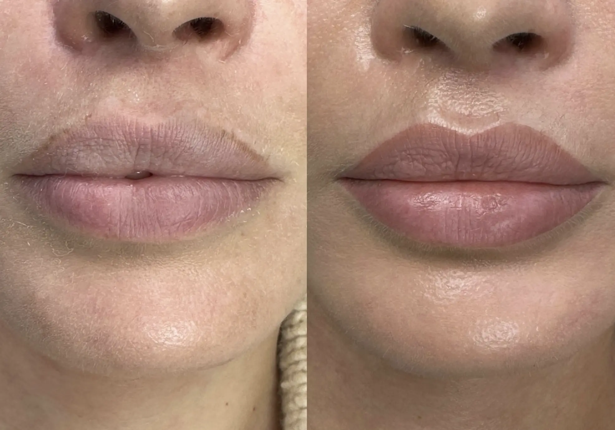 Longevity Of Lip Tattoos How Long Can You Expect Them To Last