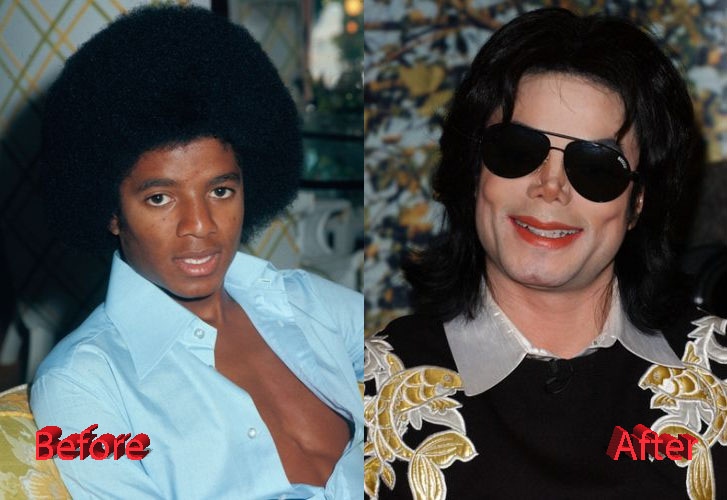 Michael Jackson Plastic Surgery: History, Rumors, And Impact