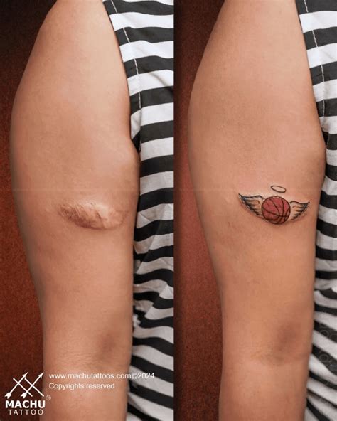 Scar Coverups Using Tattoos Hart Amp Huntington Tattoo Co Orlando