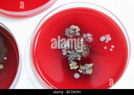 Staphylococcus Epidermidis Temperature In Incubator: Lab Guidelines