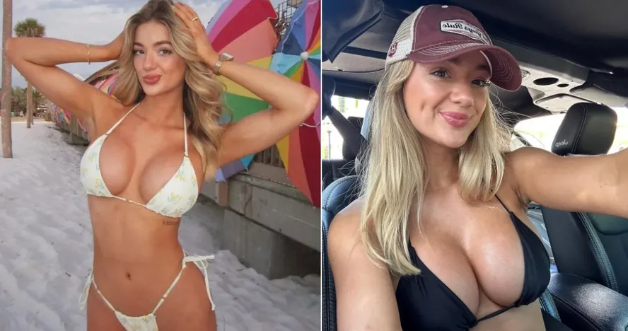 V Tima De Ataque De Tubar O Faz Sucesso Como Modelo Cicatriz Fascina