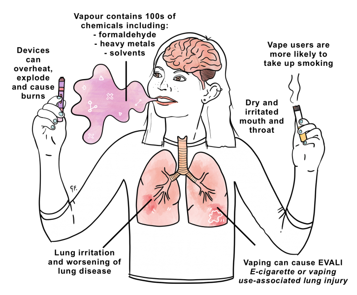 Vaping Amp Young People Kidshealth Nz